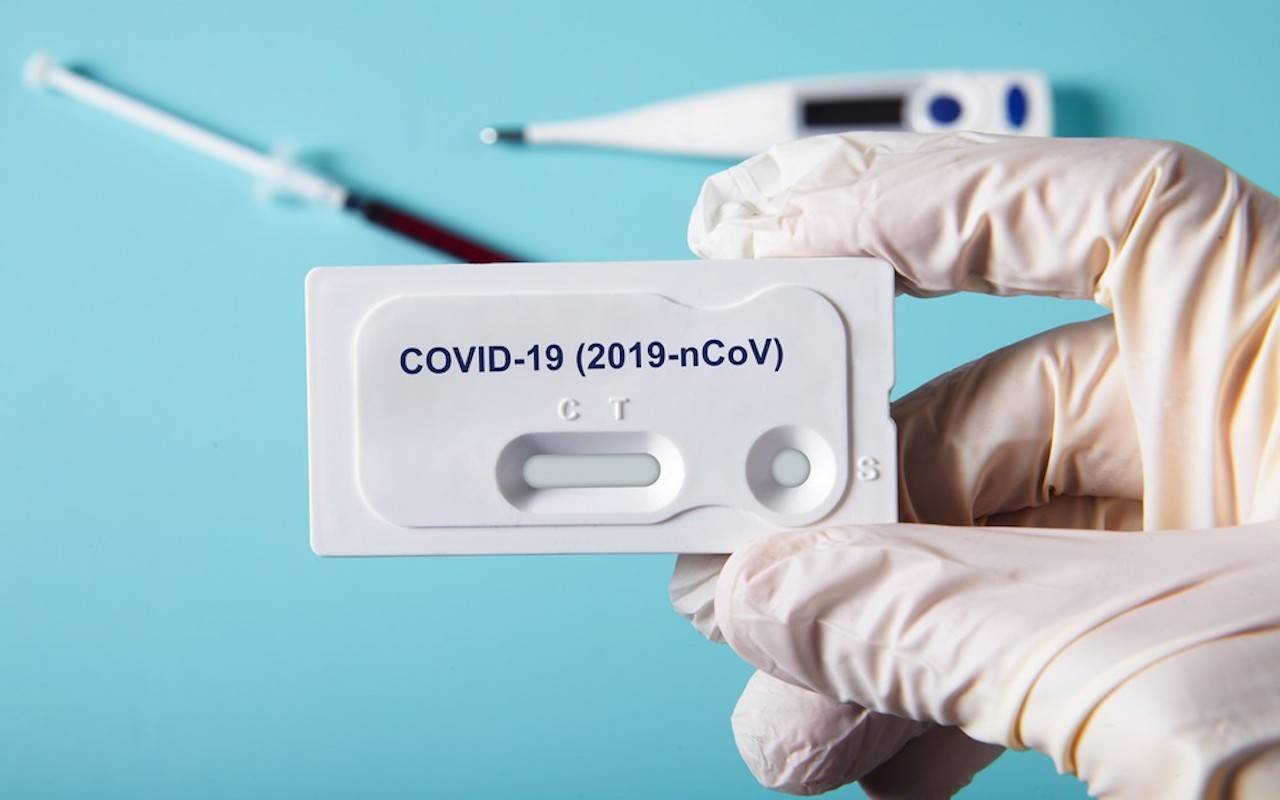 test coronavirus fai da te